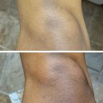 Nasola Kojic Acid Lotion photo review