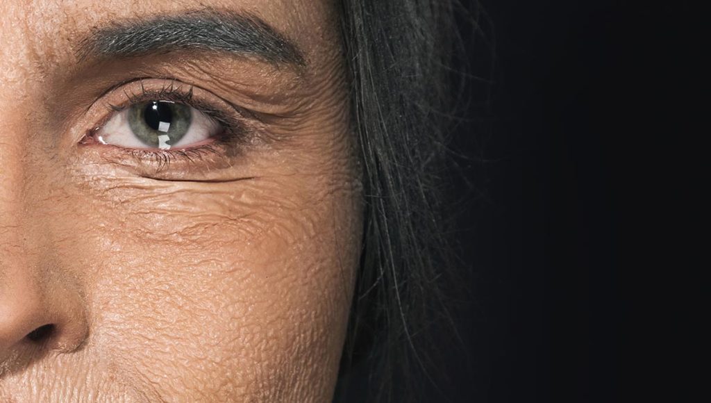 Targeted Care: Addressing Crepey Skin Under Eyes
