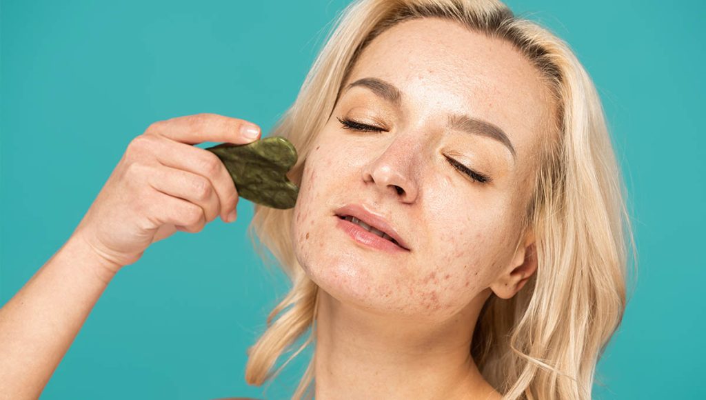 The perfect Toner for Oily Skin and Acne