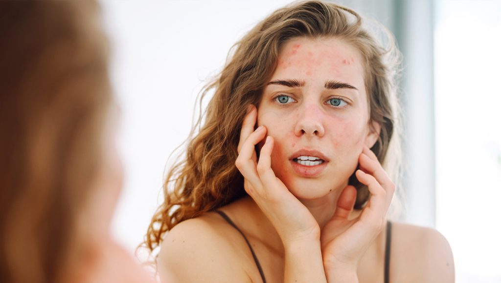Ingredient Spotlight: Kojic Acid – A Dermatologist-Loved Brightening Ingredient That Mimics Korean Skincare Efficacy