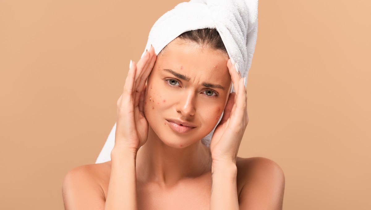 Does Niacinamide Help with Dark Spots and Acne Scars?